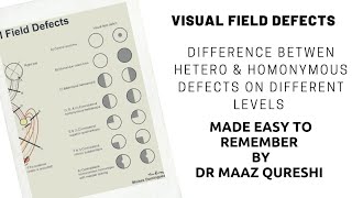 Visual Pathway amp Field Defects  lesions  On Different Levels  Made Easy  Homo amp Heteronymous [upl. by Attiuqal]