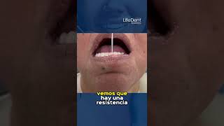 PRueba de resistencia en prótesis total dental [upl. by Brower]