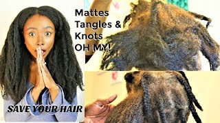 Quick ACVApple Cider Vinegar Dentagle for Braids Build Up on Natural Hair [upl. by Crain792]