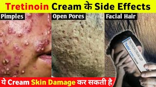 Tretinoin Cream के ये Side Effects आप नहीं जानते होगे 😱 [upl. by Nowell]