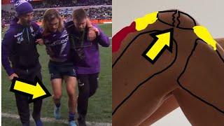 Ryan Papenhuyzens SEASONENDING Kneecap Injury Explained [upl. by Cha]