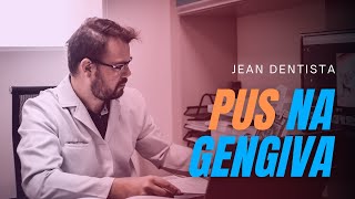 😵INFECÇÃO PUS NA GENGIVA  O que fazer quando aparece uma bola de pus na gengiva [upl. by Breeze]