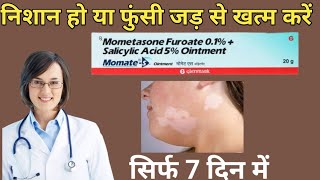 momate s ointment use in hindi mometasone salicylic acid [upl. by Nailij]