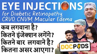 Eye Injections for Retina Treatments Explained  DocPods  Episode 1 [upl. by Ykciv]