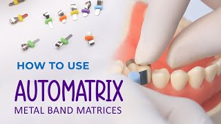 How to use Automatrix Metal Band Matrices [upl. by Zucker]