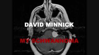 My Schwannoma  David Minnick Version [upl. by Edorej]