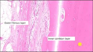 Basic bone pathology with case examples [upl. by Beacham]