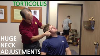 EXTREME neck pain amp TORTICOLLIS are GONE with HUGE NECK ADJUSTMENTs SoCalChiropractic [upl. by Adair]