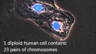 A microscopic view of a buccal swab sample for DNA analysis [upl. by Nellak346]