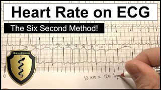 ECG Heart Rate Calculation  The Six Second Method [upl. by Repsac]