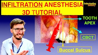 QUICK TUTORIAL ALL Techniques of Local Anesthesia in Dentistry Lecture [upl. by Eibob]