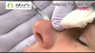 RELLENOS FACIALES  Okara Medicina Estética Láser [upl. by Ardek]