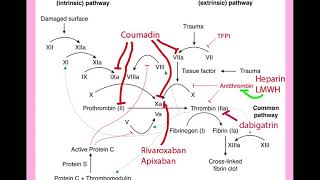 Thrombophilia in Pregnancy  CRASH Medical Review Series [upl. by Notle]