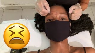 I TRIED MICROBLADING AND THIS HAPPENED first review  updates [upl. by Holsworth171]