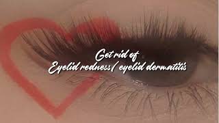 ༻✧ Get rid of eyelid dermatitis eyelid redness✧ ༻ [upl. by Barraza]