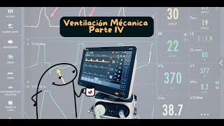 Ventilación Mecánica IV uci ventilaciónmecánica terapiarespiratoria critico cuidadointensivo [upl. by Eeldivad]