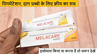 Melacare Cream Review in Hindi  100 Honest  Dark Spots Pigmentation Cream [upl. by Aicertal804]