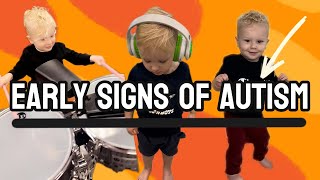 Early Signs of Autism [upl. by Aisa]