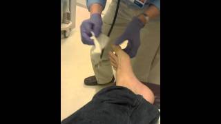 How to Reset a dislocated toe [upl. by Suzan]