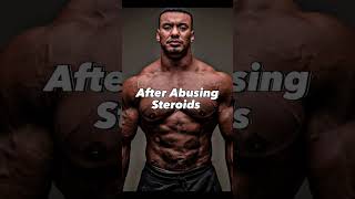 Bodybuilders Before And After Abusing Steroids [upl. by Phelia]