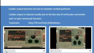 Advanced Life Support Shockable and Non Shockable Rhythms [upl. by Eglanteen]