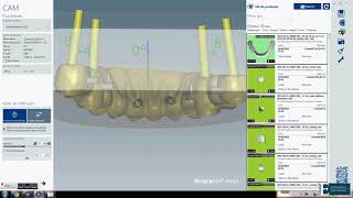 Ceramill Match 2  Zolid HT  White [upl. by Nortal]