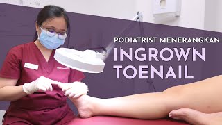 Podiatrist Menerangkan Ingrown Toenail  Ari Tria Singapore Podiatrist [upl. by Neros]