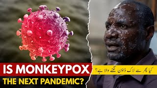 Monkeypox Explained in 5 Minutes Symptoms Spread and Prevention Tips  Strange Diary [upl. by Myrlene]