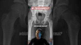 Don’t Freak Out  Diagnose This Hip Pain⁉️ shorts [upl. by Fairbanks]