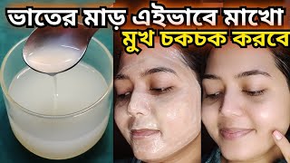 ভাতের মাড় রোজ মুখে এইভাবে মাখো রং ফর্সা ও চকচকে হবেSkin whitening packFairness packDtan pack [upl. by Aretta]