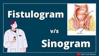 Fistulogram vs Sinogram Radiology Procedure Hindi English [upl. by Schlessinger485]