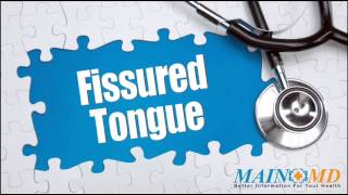 Fissured Tongue ¦ Treatment and Symptoms [upl. by Nyraa]