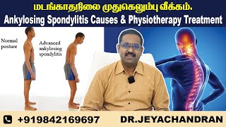 Ankylosing Spondylitis best Treatment மடங்காதநிலை முதுகெலும்பு வீக்கம்   Sun Hospital  Madurai [upl. by Dori]