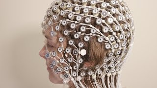 EEG brain tests help patients overcome depression [upl. by Ainegul12]