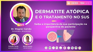 Dermatite Atópica e o tratamento no SUS [upl. by Braasch857]