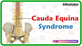 Cauda equina syndrome  Clinical anatomy  USMLE Step 1 [upl. by Asilenna]