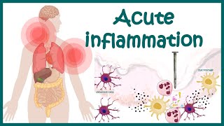 Acute Inflammation  symptoms Pathogenesis Cause of inflammation Mediators of Acute Inflammation [upl. by Daren]