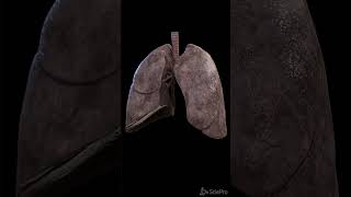 What a smokers lung looks like anatomy meded [upl. by Gretta52]