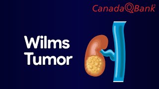 Wilms Tumor [upl. by Ycak401]