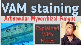 Staining of Arbuscular Mycorrhizal FungusVAMHariom LondheRohit Mane Scientistracademy [upl. by Livingston]