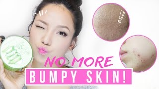 Get rid of Tiny Bumps amp Pimples in ONE WEEK it works [upl. by Jepson]