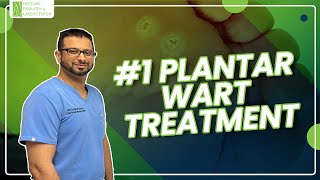 1 Plantar Warts Treatment NewYork Podiatrist DrBhela PlantarWarts [upl. by Eddana]