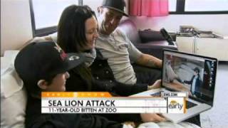 Sea Lion Attacks Boy [upl. by Arondel]