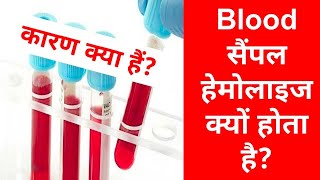 blood sample hemolyzed Kyun hota hai  hemolyzed serum sample in hindi [upl. by Sisco294]