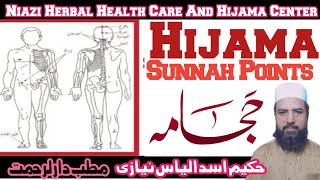 Hijama Sunah Point warak point [upl. by Christabella]