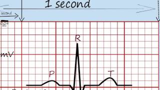 Ekg Okuma1 [upl. by Arrais]