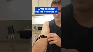 kinesiotaping for elbow pain  brachioradialis muscle [upl. by Lupien]