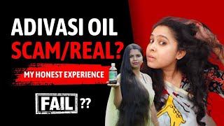 Adivasi Oil FAIL 2 Months Honest Review adivasihairoil anantambani haircare crownsaesthetics [upl. by Lebasy]