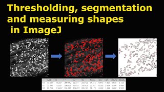 Thresholding segmentation and measuring shapes in ImageJ [upl. by Arakihc]