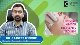 CORTISONE INJECTIONS FOR PIMPLES  Benefits amp Side Effects  Dr Rajdeep Mysore Doctors Circle [upl. by Bink987]